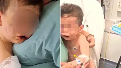 Denizli'de 2 Yaşındaki Bebek Dövüldü: Anne Anlattı